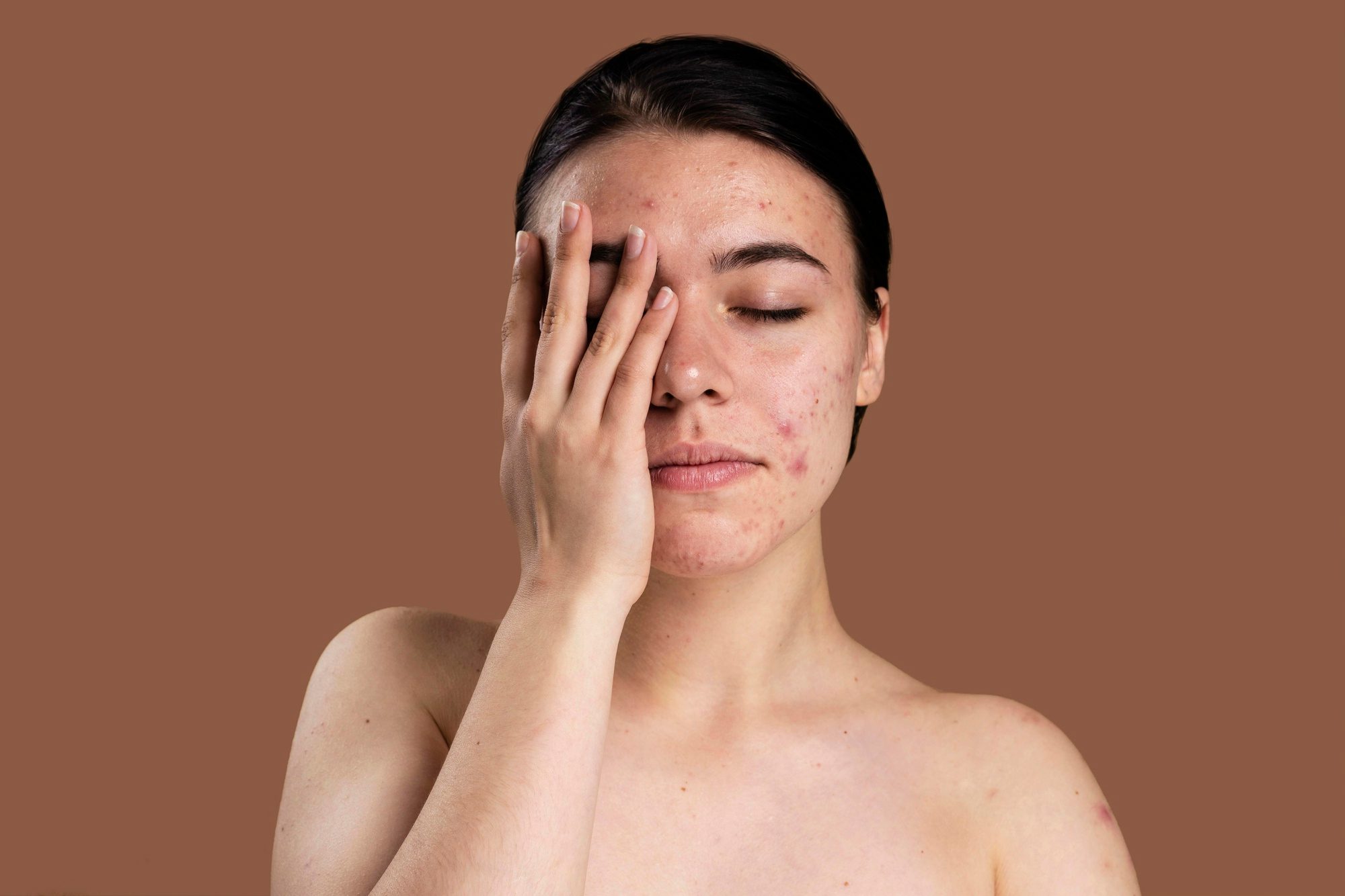 What You Should Do to Prevent Dry Skin